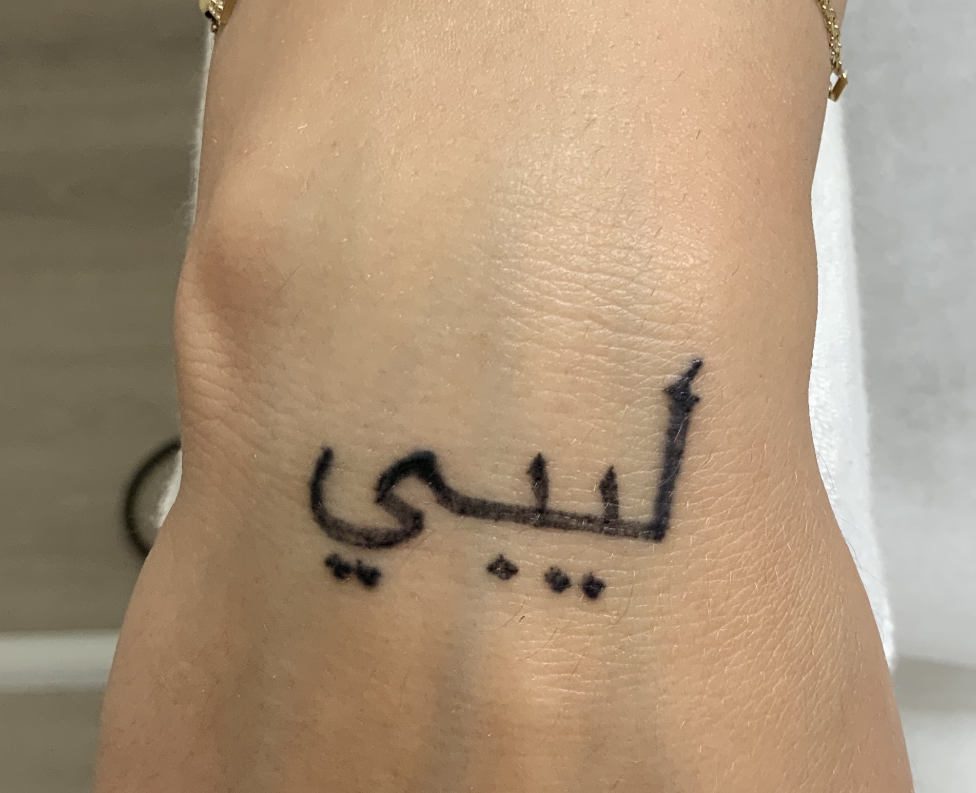 Tattooentfernung Vorher