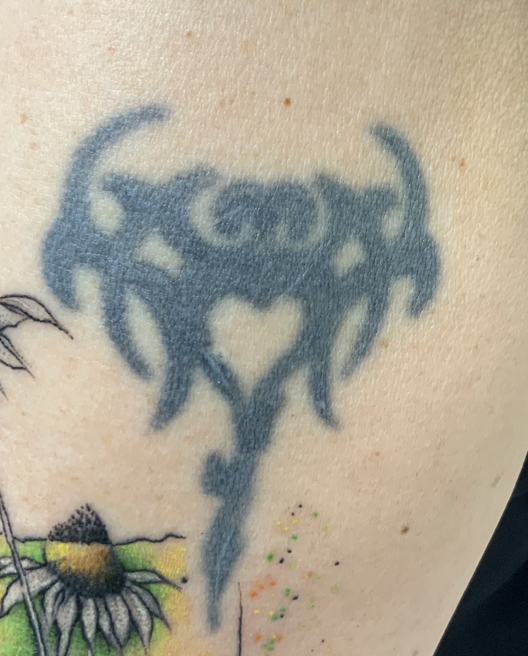 Älteres Tattoo vor der Laserbehandlung